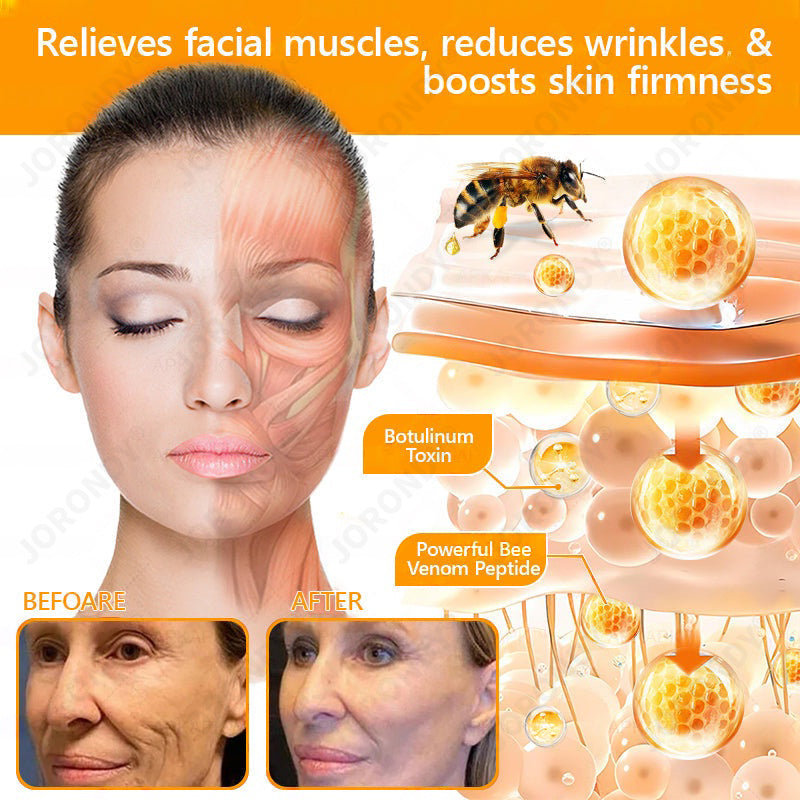 🐝 JORONDY® Bee Venom Senile Purpura Cream:Still struggling? Get a Second Box at an extra 30% Off – One for Home, One for On-the-Go!