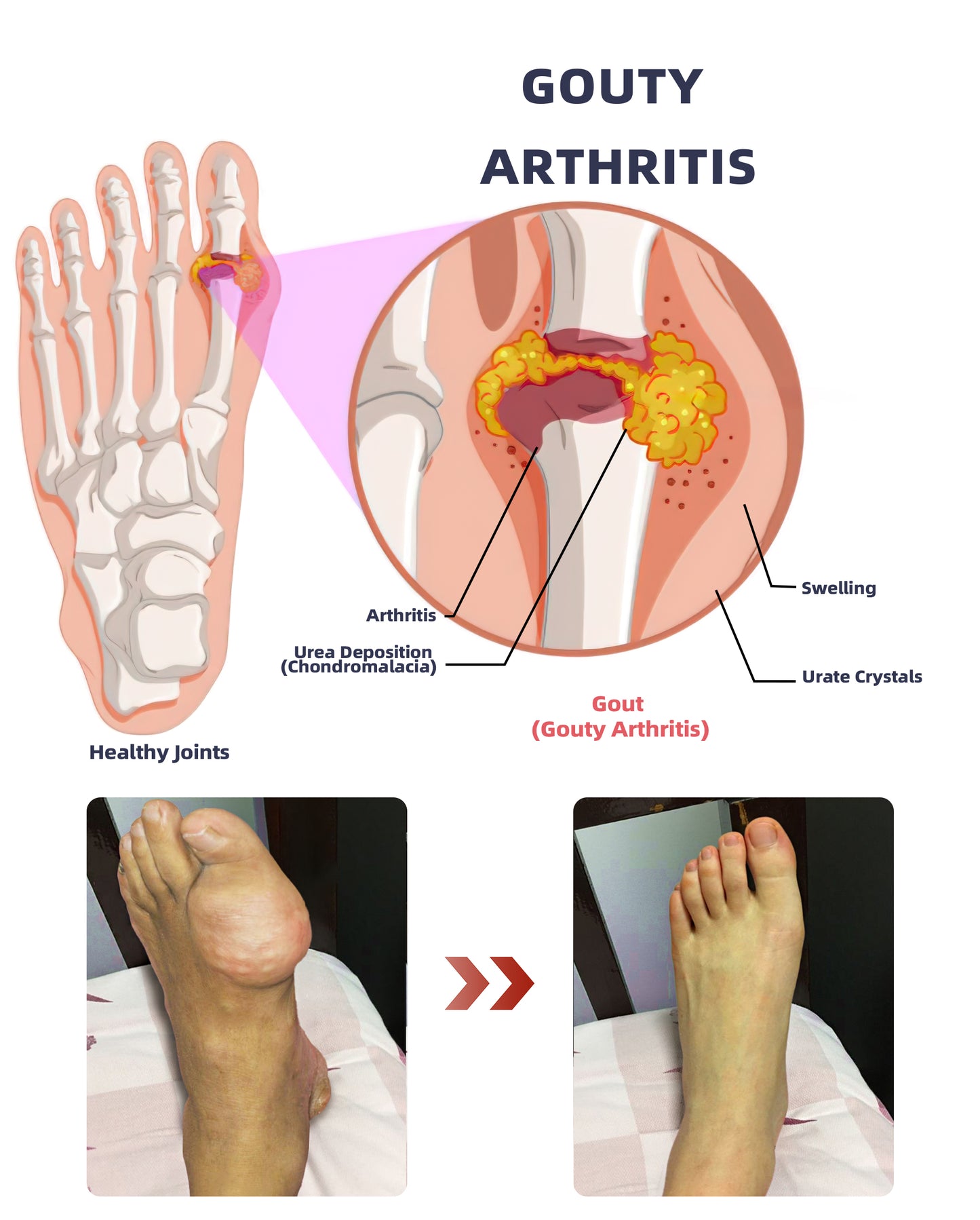 ADFIRE™ Dual Action Joint Therapy Cream