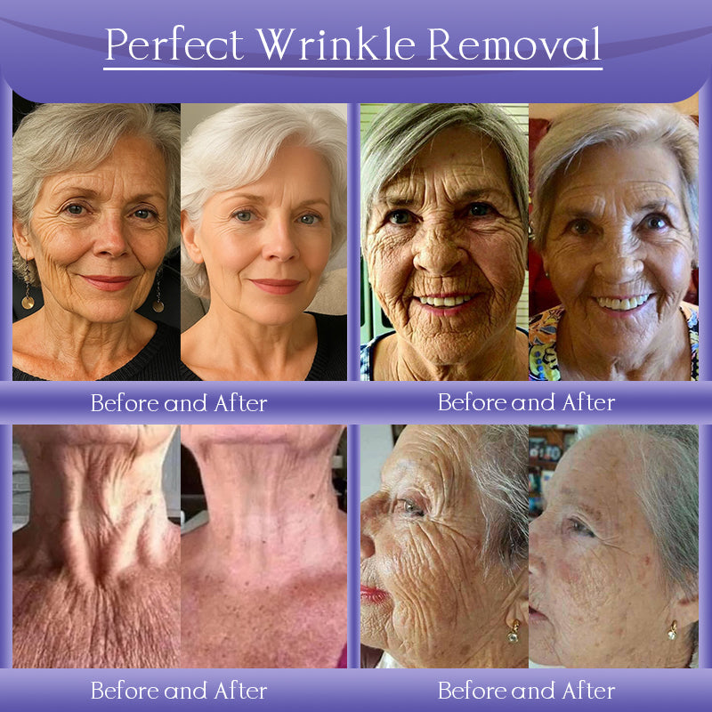 Congratulations on getting an extra 50% discount! One in a thousand chance! Last 25 pieces in stock! Dermatologist recommended!