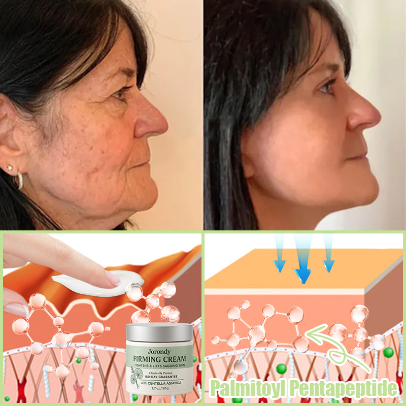 Jorondy® Firming Cream——Visibly Firms in Just 21 Days – Without Surgery or Irritation.