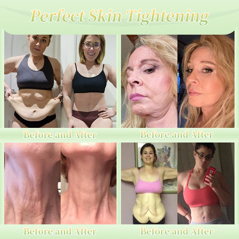 Jorondy® Firming Cream——Visibly Firms in Just 21 Days – Without Surgery or Irritation.