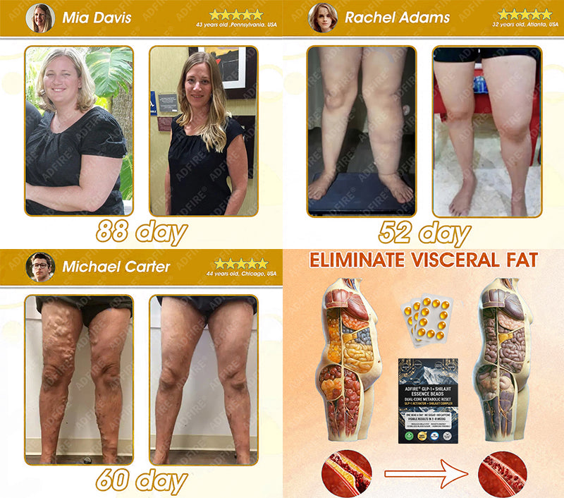 𝐀𝐝𝐟𝐢𝐫𝐞® 𝐆𝐋𝐏-𝟏 + 𝐒𝐡𝐢𝐥𝐚𝐣𝐢𝐭 𝐃𝐮𝐚𝐥-𝐂𝐨𝐫𝐞 𝐌𝐞𝐭𝐚𝐛𝐨𝐥𝐢𝐜 & 𝐑𝐞𝐬𝐭𝐨𝐫𝐚𝐭𝐢𝐨𝐧 𝐔𝐥𝐭𝐫𝐚-𝐂𝐨𝐧𝐜𝐞𝐧𝐭𝐫𝐚𝐭𝐞𝐝 𝐄𝐬𝐬𝐞𝐧𝐜𝐞 𝐁𝐞𝐚𝐝𝐬 — 𝐒𝐜𝐢𝐞𝐧𝐭𝐢𝐟𝐢𝐜 𝐅𝐚𝐭 𝐁𝐮𝐫𝐧 × 𝐇𝐞𝐫𝐛𝐚𝐥 𝐑𝐞𝐣𝐮𝐯𝐞𝐧𝐚𝐭𝐢𝐨𝐧, 𝐅𝐮𝐥𝐥𝐲 𝐀𝐜𝐭𝐢𝐯𝐚𝐭𝐢𝐧𝐠 𝐭𝐡𝐞 𝐁𝐨𝐝𝐲’𝐬 𝐌𝐞𝐭𝐚𝐛𝐨𝐥𝐢𝐜 𝐒𝐲𝐬𝐭𝐞𝐦 (✅ 𝐁𝐥𝐨𝐨𝐝 𝐒𝐮𝐠𝐚𝐫 𝐂𝐨𝐧𝐭𝐫𝐨𝐥, 𝐅𝐚𝐭 𝐋𝐨𝐬𝐬, 𝐇𝐞𝐚𝐫𝐭 𝐇𝐞𝐚𝐥𝐭𝐡, 𝐀𝐧𝐭𝐢-𝐀𝐠𝐢𝐧𝐠)
