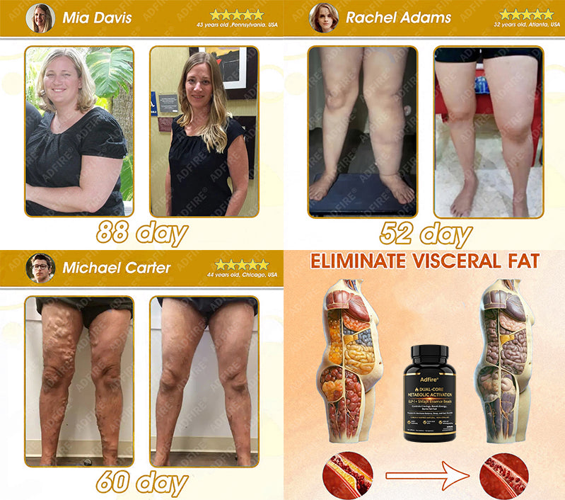 𝐀𝐝𝐟𝐢𝐫𝐞® 𝐆𝐋𝐏-𝟏 + 𝐒𝐡𝐢𝐥𝐚𝐣𝐢𝐭 𝐃𝐮𝐚𝐥-𝐂𝐨𝐫𝐞 𝐌𝐞𝐭𝐚𝐛𝐨𝐥𝐢𝐜 & 𝐑𝐞𝐬𝐭𝐨𝐫𝐚𝐭𝐢𝐨𝐧 𝐔𝐥𝐭𝐫𝐚-𝐂𝐨𝐧𝐜𝐞𝐧𝐭𝐫𝐚𝐭𝐞𝐝 𝐄𝐬𝐬𝐞𝐧𝐜𝐞 𝐁𝐞𝐚𝐝𝐬 — 𝐒𝐜𝐢𝐞𝐧𝐭𝐢𝐟𝐢𝐜 𝐅𝐚𝐭 𝐁𝐮𝐫𝐧 × 𝐇𝐞𝐫𝐛𝐚𝐥 𝐑𝐞𝐣𝐮𝐯𝐞𝐧𝐚𝐭𝐢𝐨𝐧, 𝐅𝐮𝐥𝐥𝐲 𝐀𝐜𝐭𝐢𝐯𝐚𝐭𝐢𝐧𝐠 𝐭𝐡𝐞 𝐁𝐨𝐝𝐲’𝐬 𝐌𝐞𝐭𝐚𝐛𝐨𝐥𝐢𝐜 𝐒𝐲𝐬𝐭𝐞𝐦 (✅ 𝐁𝐥𝐨𝐨𝐝 𝐒𝐮𝐠𝐚𝐫 𝐂𝐨𝐧𝐭𝐫𝐨𝐥, 𝐅𝐚𝐭 𝐋𝐨𝐬𝐬, 𝐇𝐞𝐚𝐫𝐭 𝐇𝐞𝐚𝐥𝐭𝐡, 𝐀𝐧𝐭𝐢-𝐀𝐠𝐢𝐧𝐠)