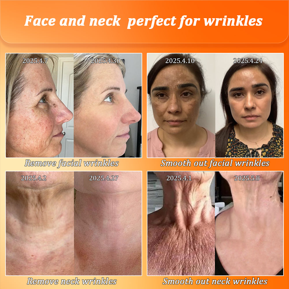Congratulations on getting an extra 50% discount! One in a thousand chance! Last 25 pieces in stock! Dermatologist recommended!
