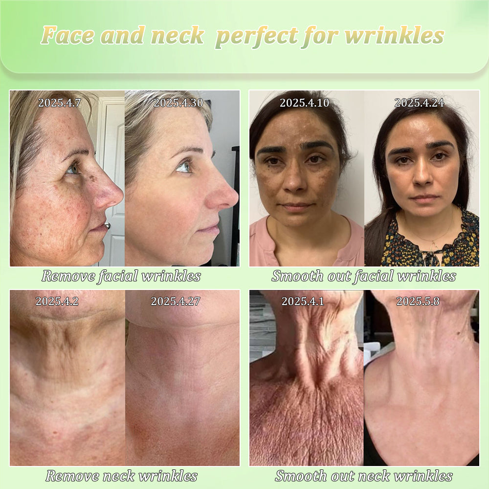 Congratulations on getting an extra 50% discount! One in a thousand chance! Last 5 pieces in stock! Dermatologist recommended!