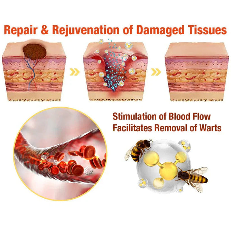 Jorondy® TagRecede Bee Venom Treatment Cream