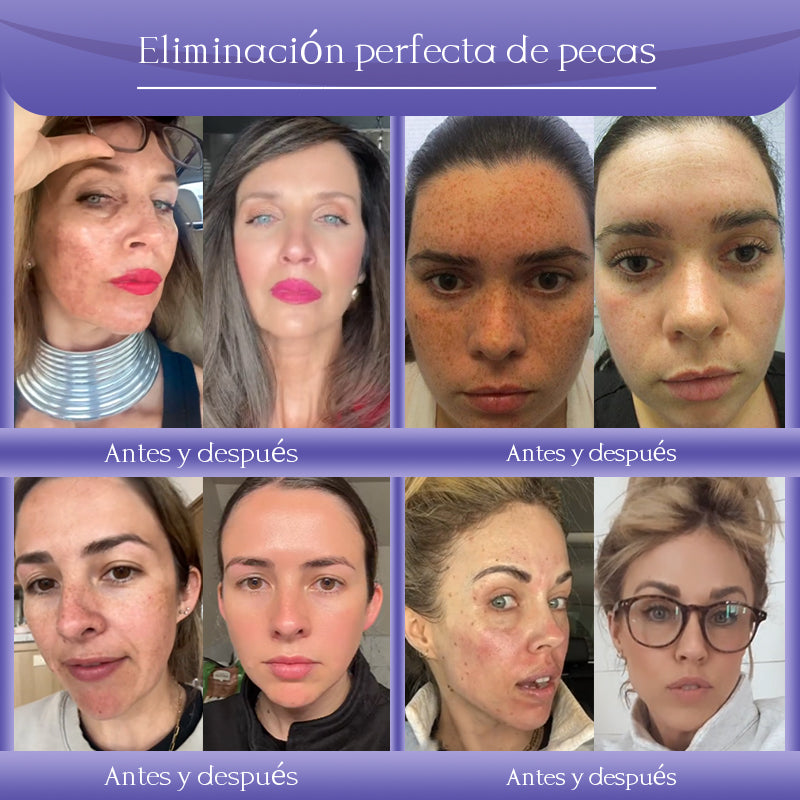 Crema antiarrugas Jorondy® para eliminar arrugas, reafirmar y blanquear la piel - ¡Última oferta!🔥 90 % de descuento.