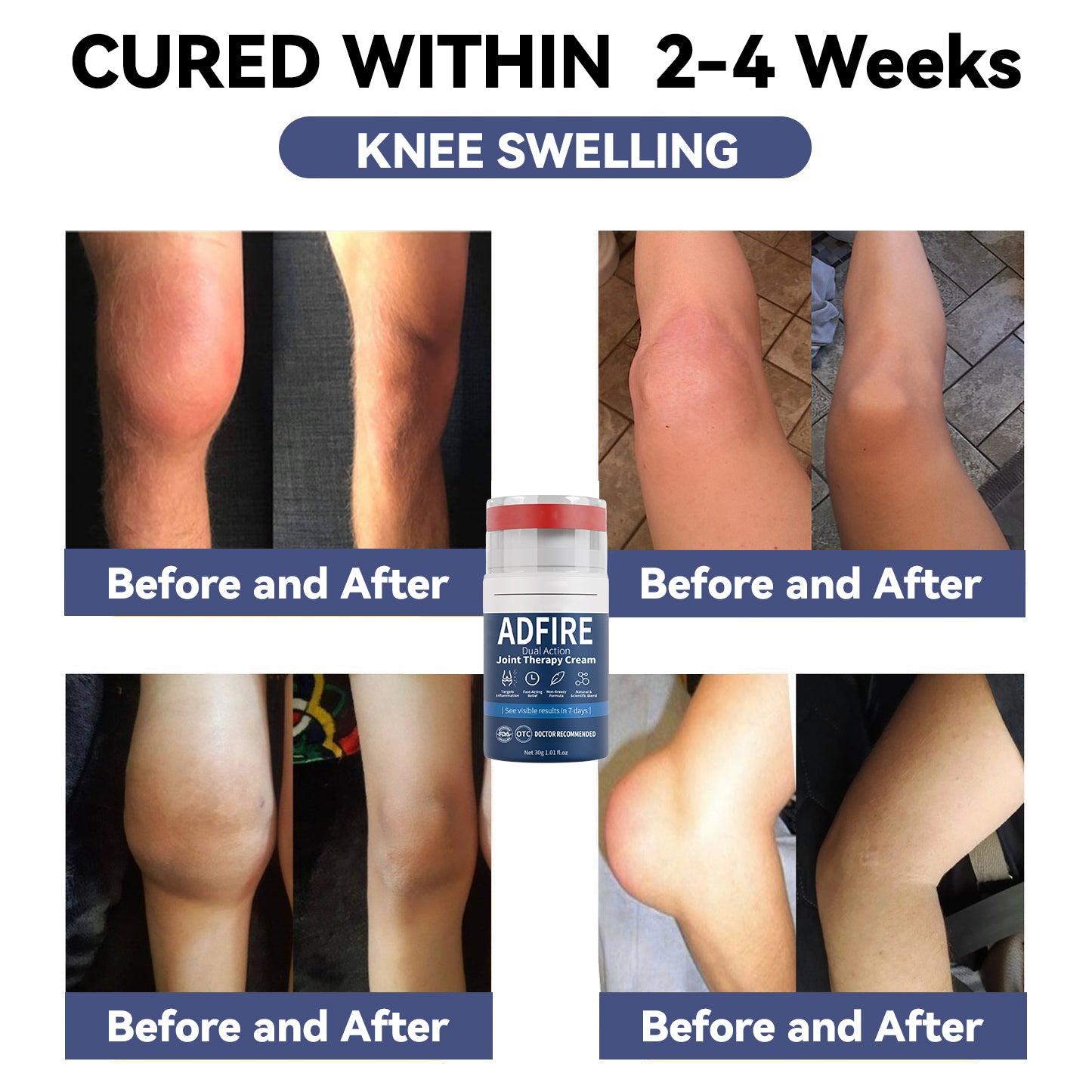 ADFIRE™ Dual Action Joint Therapy Cream