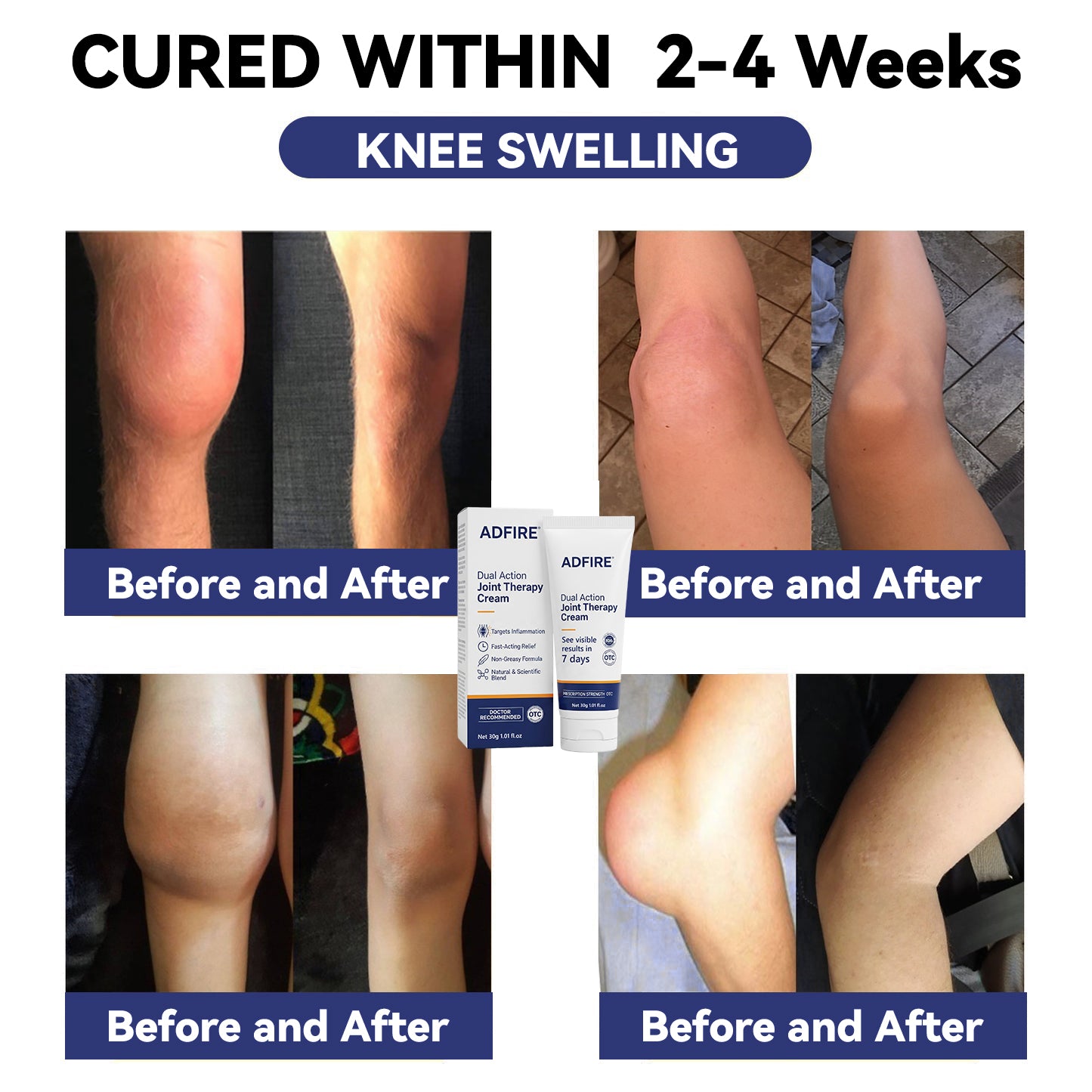 ADFIRE® Joint Genesis Protocol———The All-in-One Solution For Treating Pain All Over The Body