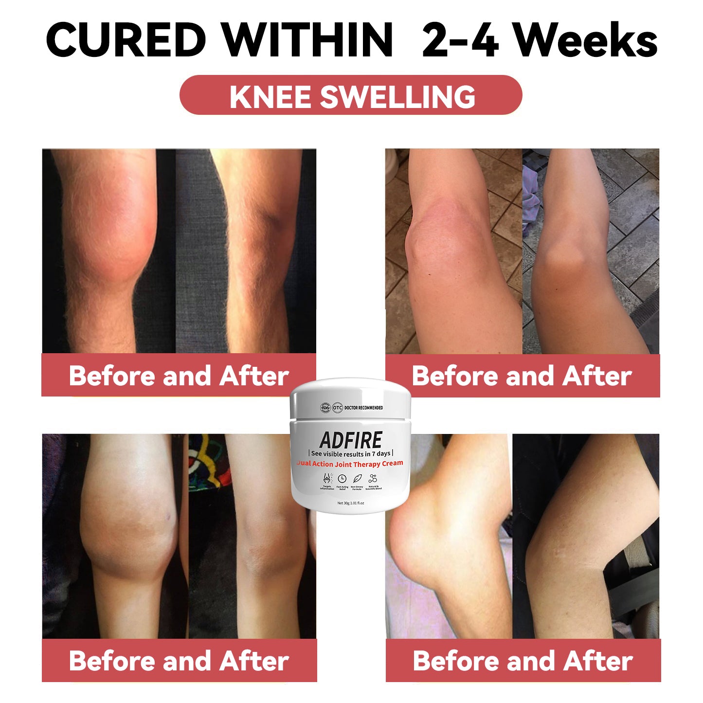 ADFIRE™ Dual Action Joint Therapy Cream