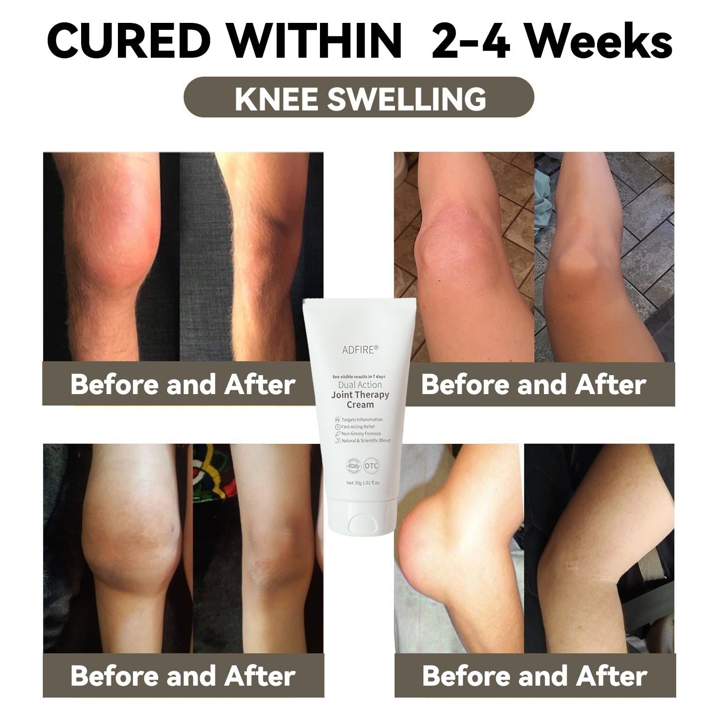 ADFIRE™ Dual Action Joint Therapy Cream