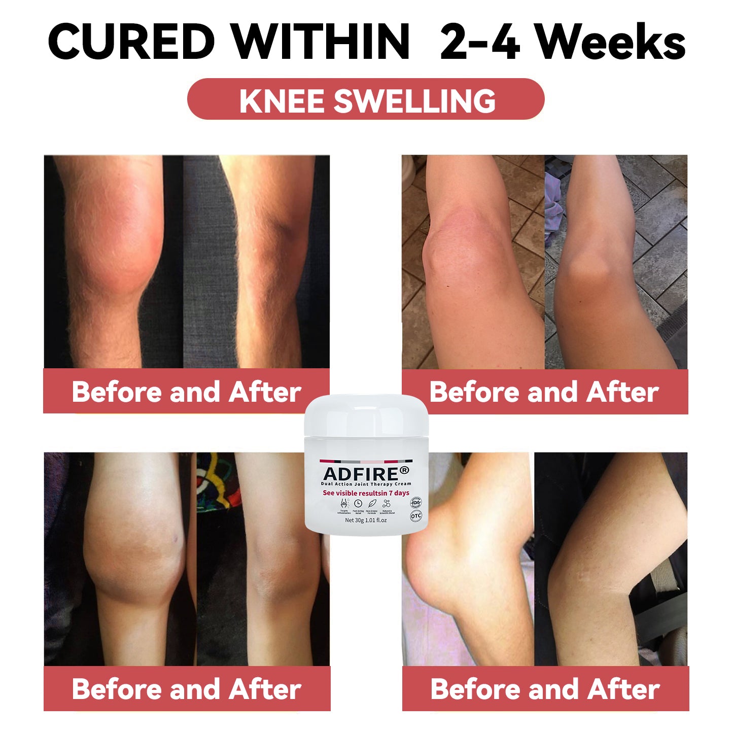 ADFIRE™ Dual Action Joint Therapy Cream