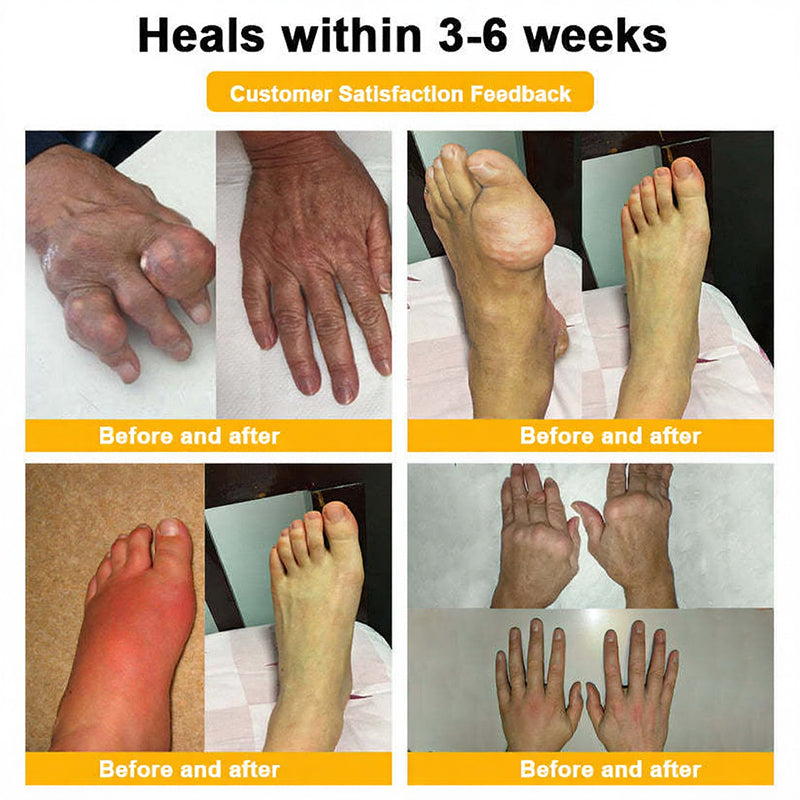 Jorondy® 🐝Bee Venom Pain-Relief Bone Healing Spray (Specially for older adults )