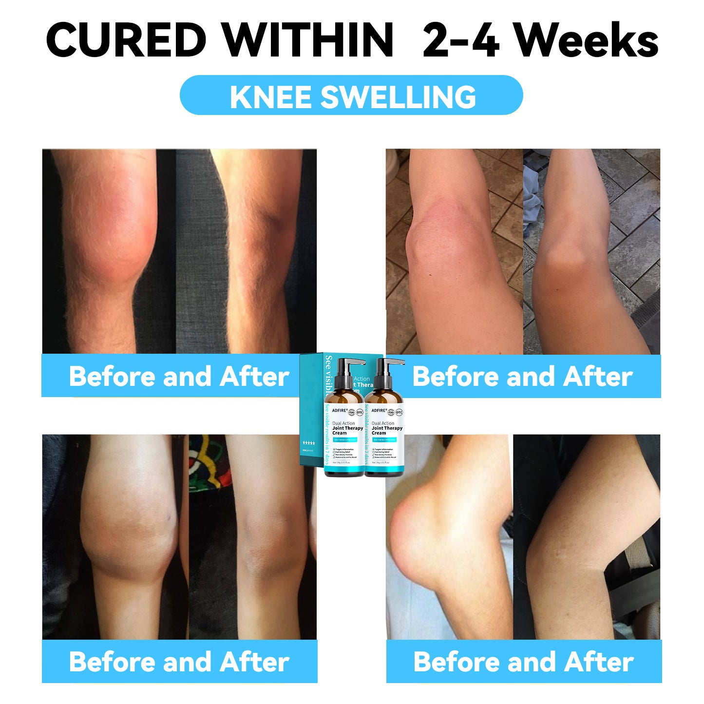 ADFIRE™ Dual Action Joint Therapy Cream