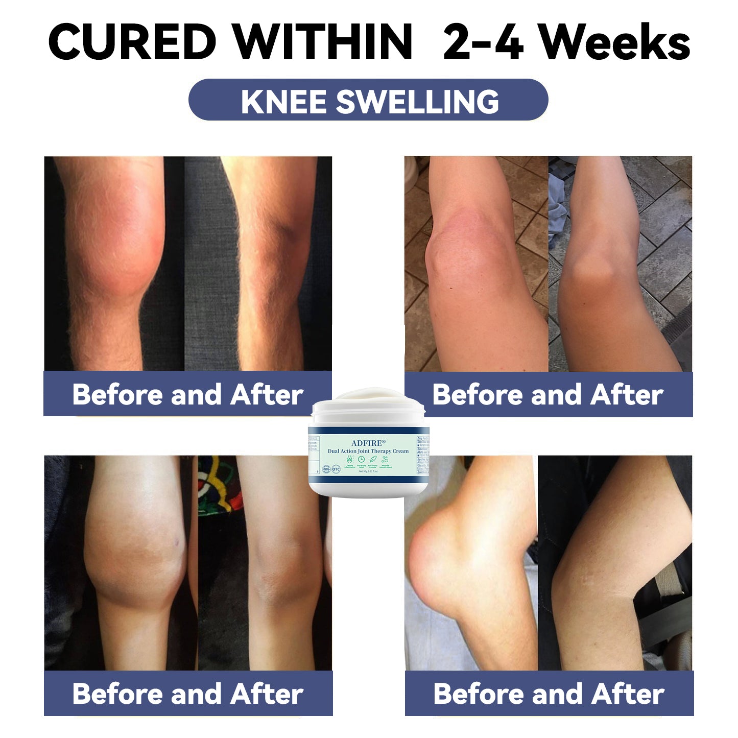 ADFIRE™ Dual Action Joint Therapy Cream