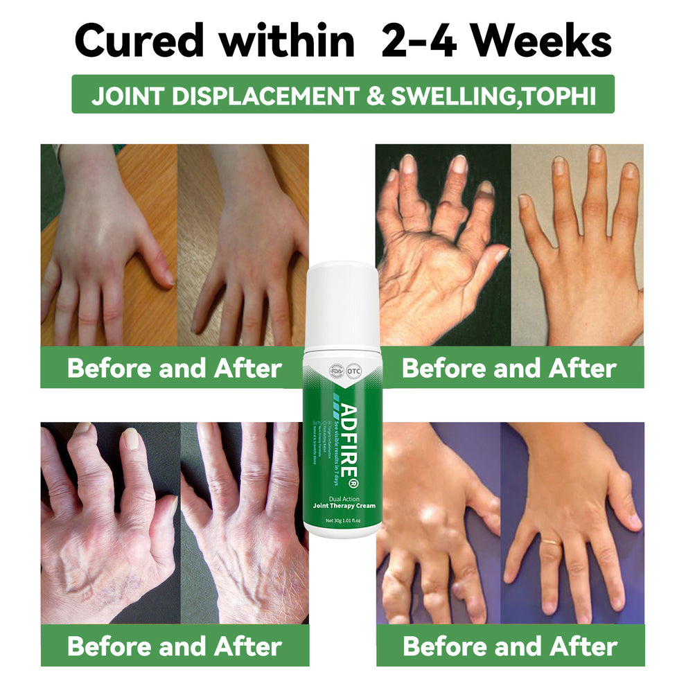 ADFIRE™ Dual Action Joint Therapy Cream