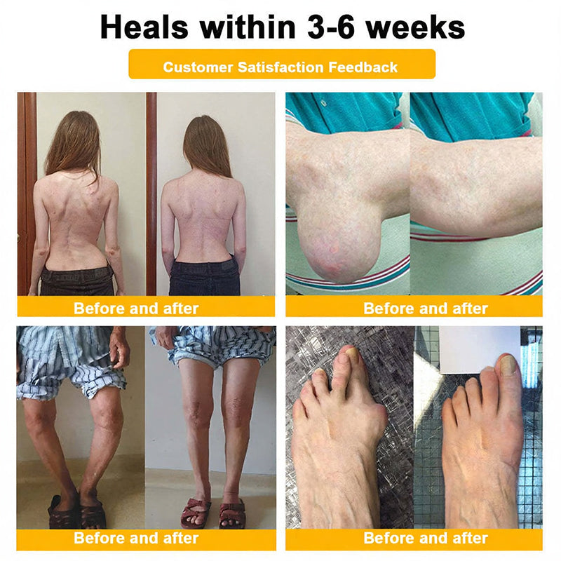 Jorondy® 🐝Bee Venom Pain-Relief Bone Healing Spray (Specially for older adults )
