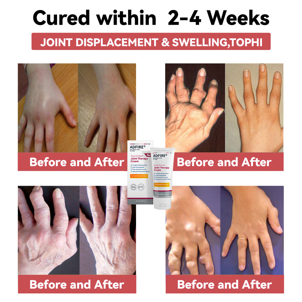 ADFIRE™ Dual Action Joint Therapy Cream