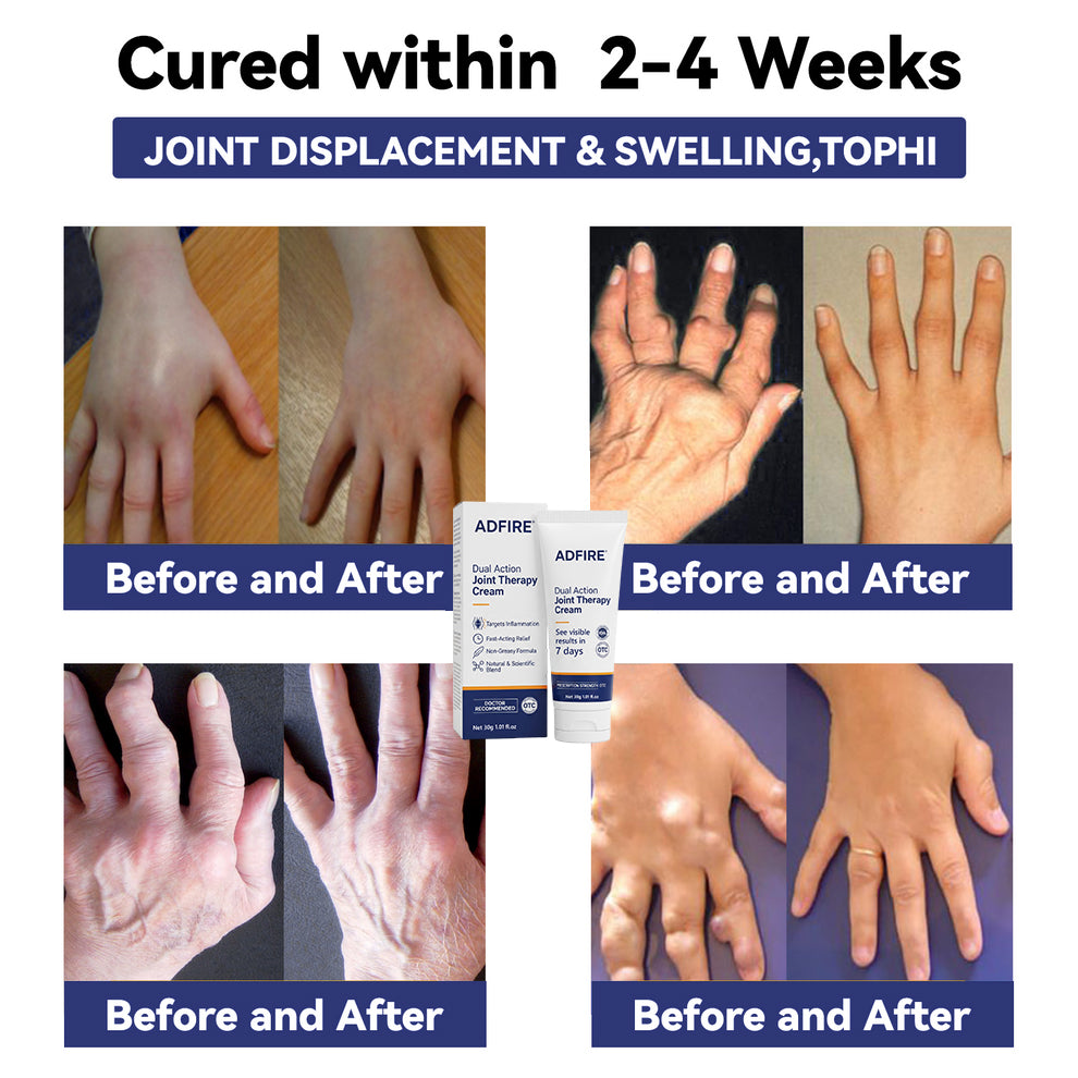 ADFIRE® Joint Genesis Protocol———The All-in-One Solution For Treating Pain All Over The Body