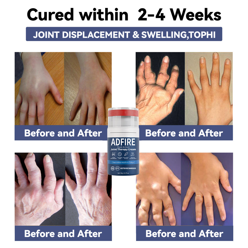 ADFIRE™ Dual Action Joint Therapy Cream