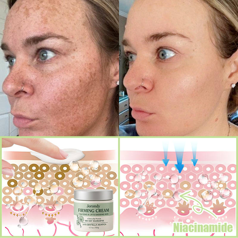 Jorondy® Firming Cream——Visibly Firms in Just 21 Days – Without Surgery or Irritation.