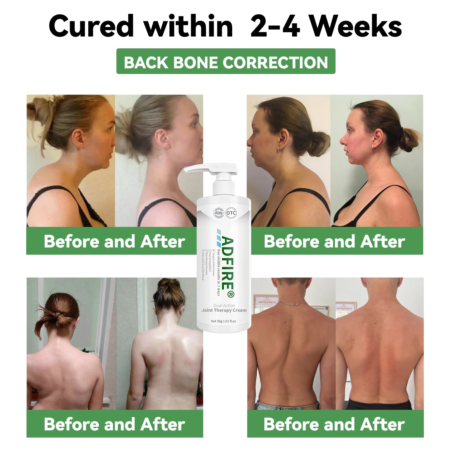 ADFIRE™ Dual Action Joint Therapy Cream