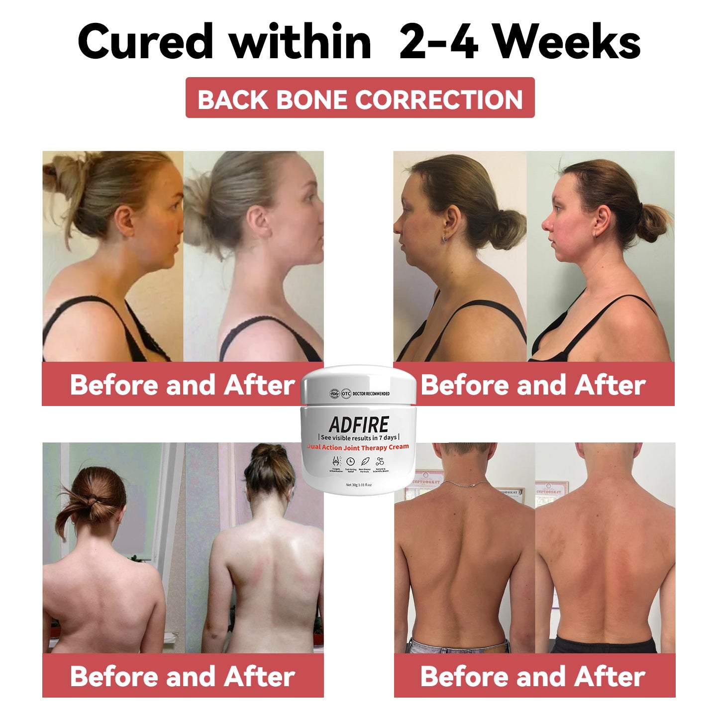 ADFIRE™ Dual Action Joint Therapy Cream