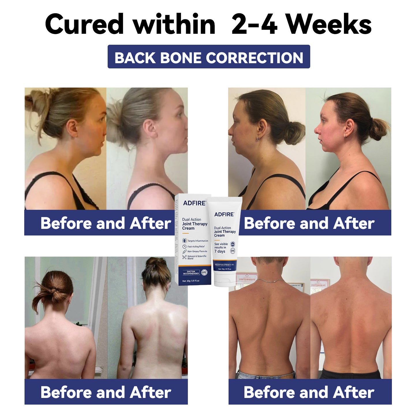 ADFIRE® Joint Genesis Protocol———The All-in-One Solution For Treating Pain All Over The Body