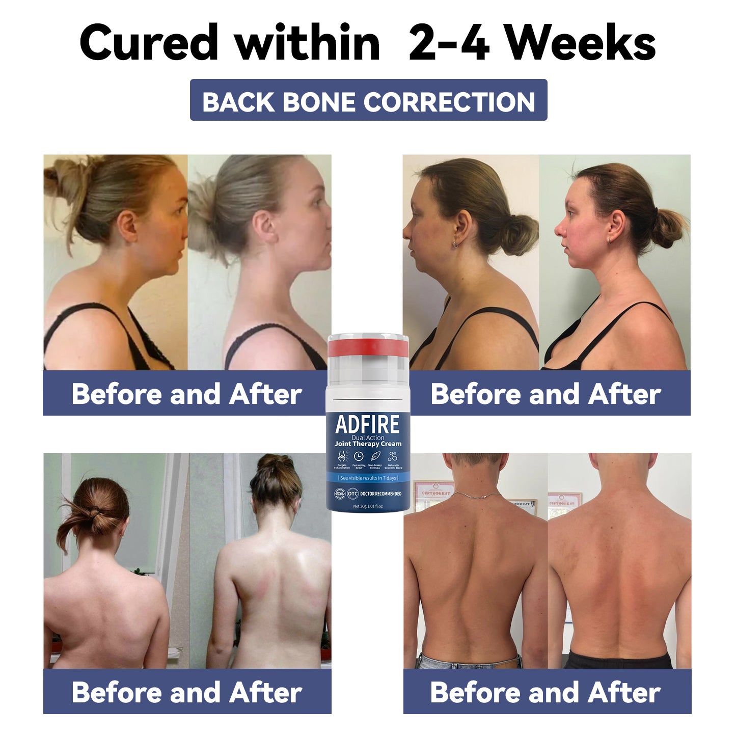 ADFIRE™ Dual Action Joint Therapy Cream