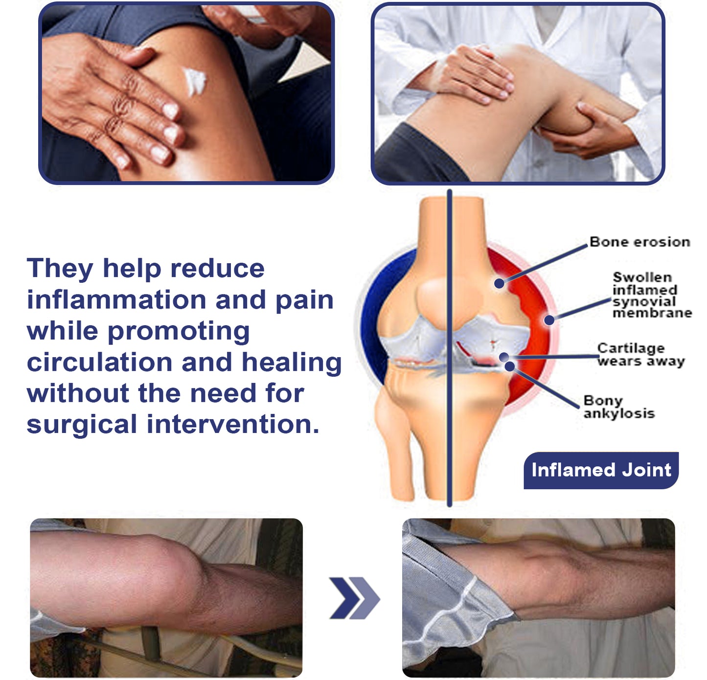 ADFIRE® Joint Genesis Protocol———The All-in-One Solution For Treating Pain All Over The Body