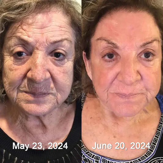 52-year-old pro-test! $30 anti-wrinkle cream smoothes out 'peri-lip lines' in four weeks: friend exclaims 'younger than 40'