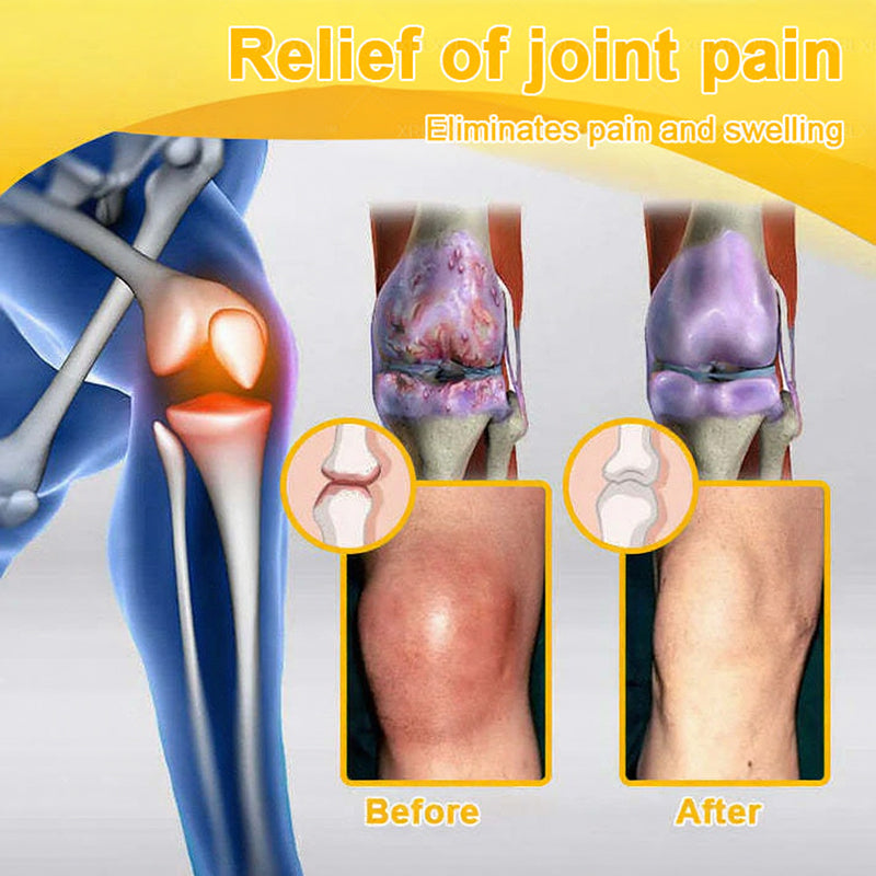 Jorondy® 🐝Bee Venom Pain-Relief Bone Healing Spray （Specially for older adults ）