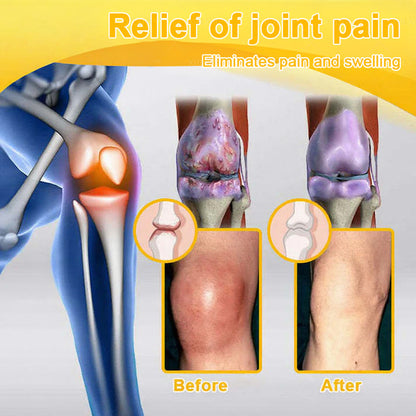 Jorondy® 🐝Bee Venom Pain-Relief Bone Healing Spray （Specially for older adults ）