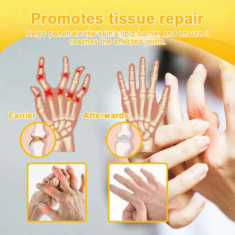 Jorondy® 🐝Bee Venom Pain-Relief Bone Healing Spray （Specially for older adults ）