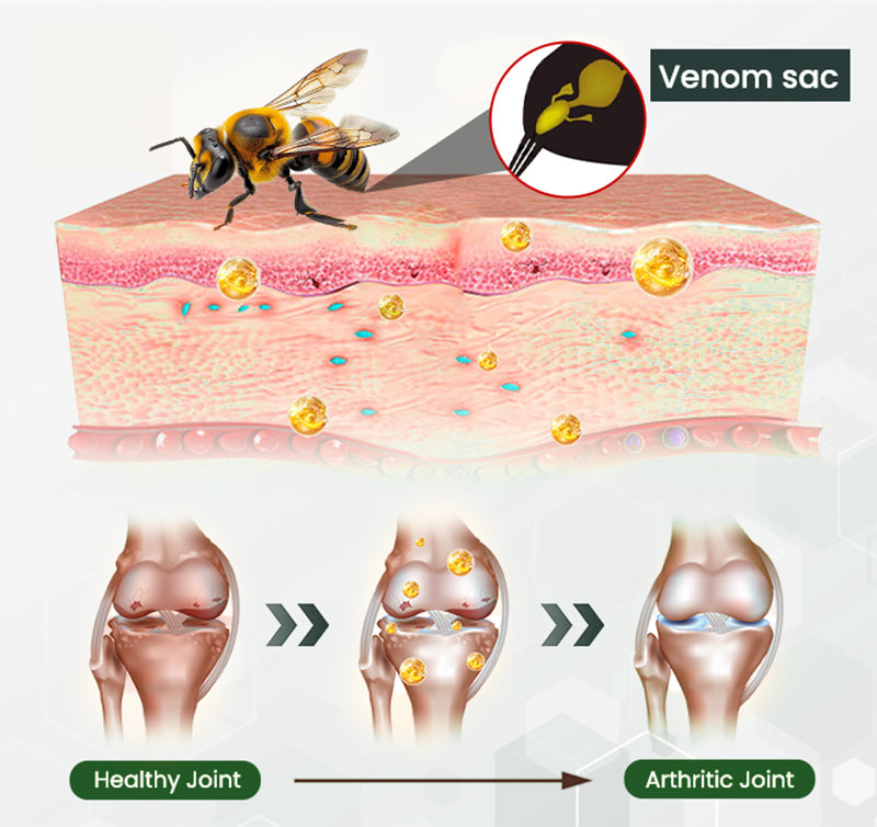 Adfire® 🔥🔥Bee Venom Bone & Joint Revive Spray