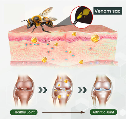 Adfire® 🔥🔥Bee Venom Bone & Joint Revive Spray