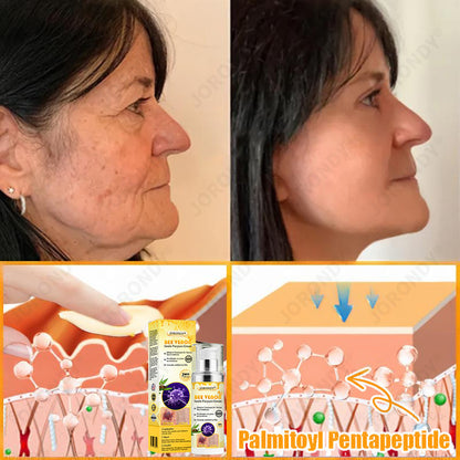🐝 JORONDY® Bee Venom Senile Purpura Cream:Still struggling? Get a Second Box at an extra 30% Off – One for Home, One for On-the-Go!