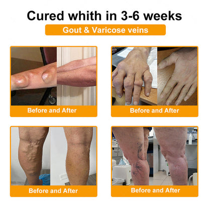 Jorondy® 🐝Bee Venom Pain-Relief Bone Healing Spray （Specially for older adults ）