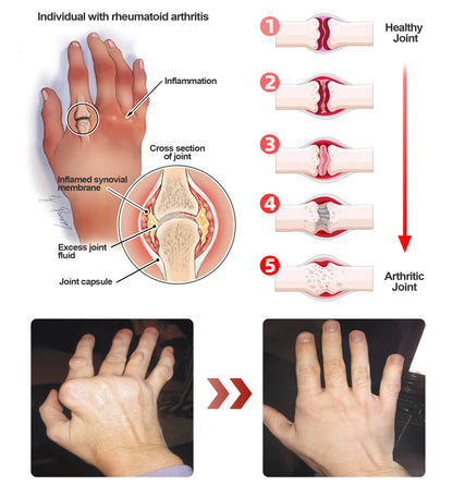 ADFIRE™ Dual Action Joint Therapy Cream