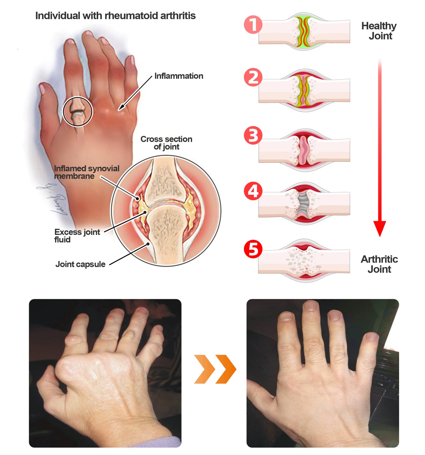 ADFIRE™ Dual Action Joint Therapy Cream
