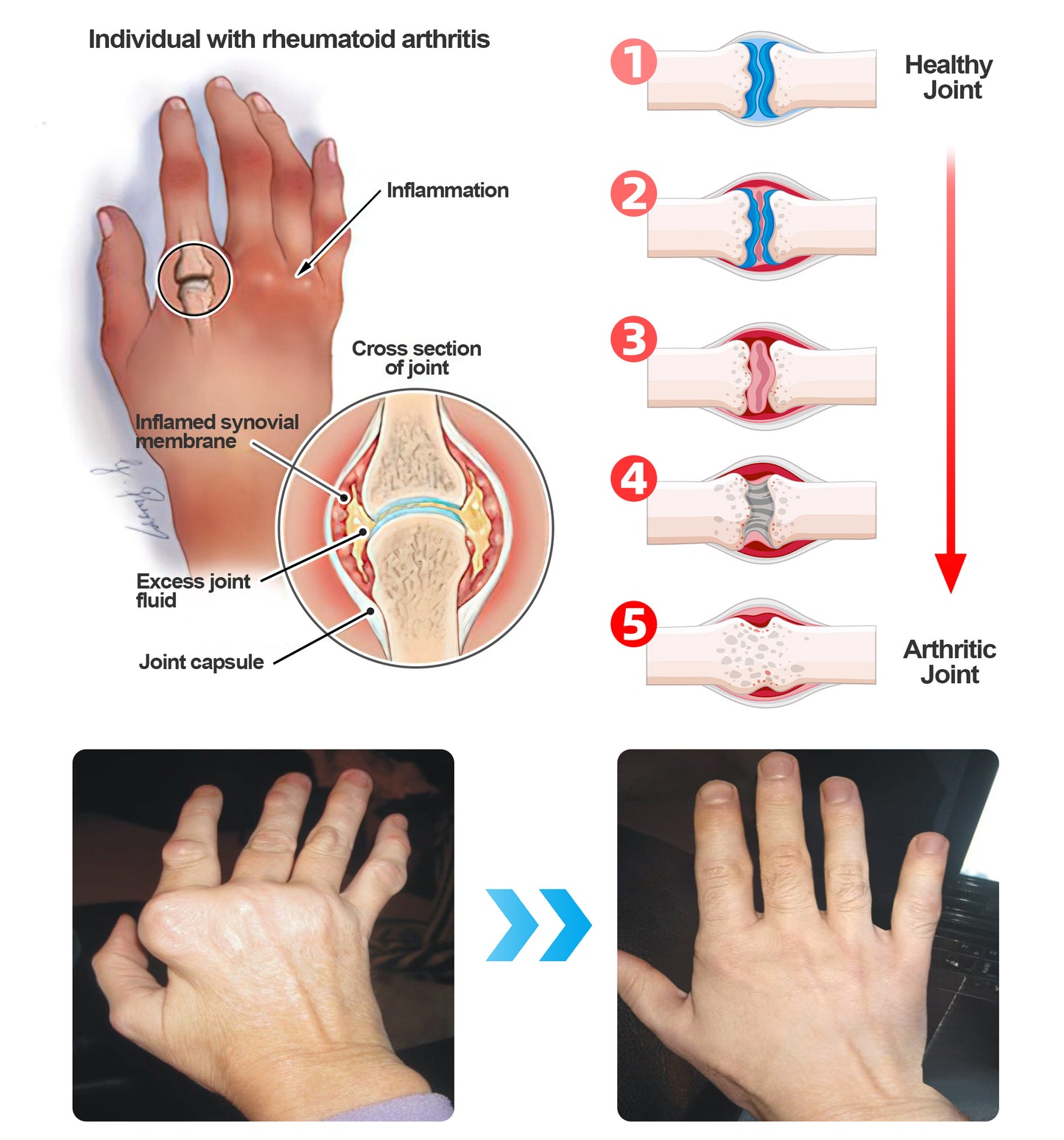 ADFIRE™ Dual Action Joint Therapy Cream