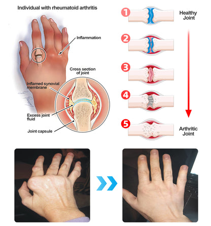 ADFIRE™ Dual Action Joint Therapy Cream