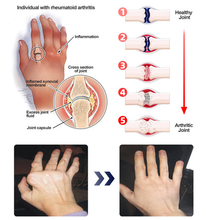 ADFIRE™ Dual Action Joint Therapy Cream