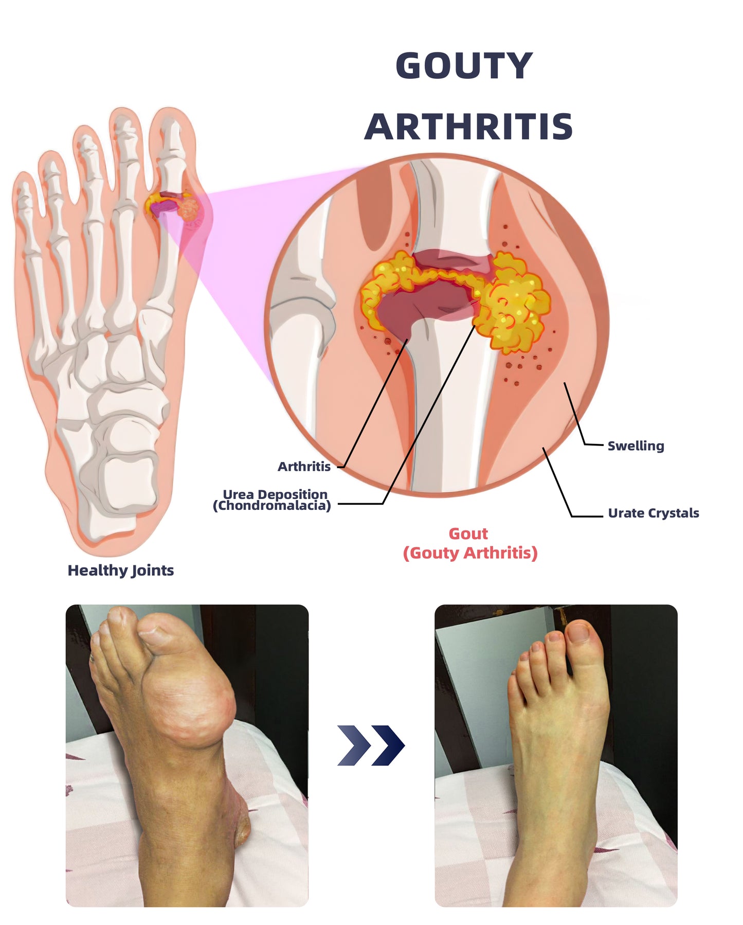 ADFIRE™ Dual Action Joint Therapy Cream