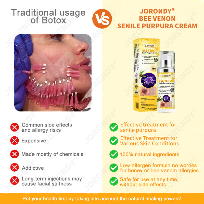 🐝 JORONDY® Bee Venom Senile Purpura Cream:Still struggling? Get a Second Box at an extra 30% Off – One for Home, One for On-the-Go!