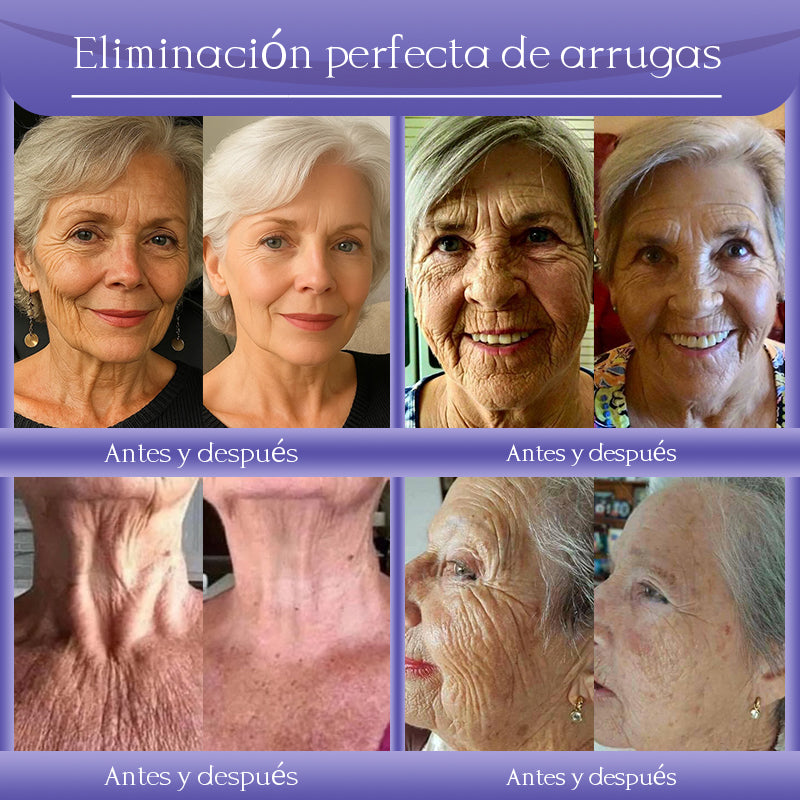 Crema antiarrugas Jorondy® para eliminar arrugas, reafirmar y blanquear la piel - ¡Última oferta!🔥 90 % de descuento.