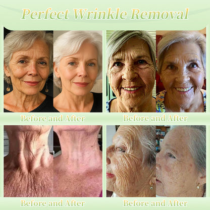 Jorondy® Firming Cream——Visibly Firms in Just 21 Days – Without Surgery or Irritation.