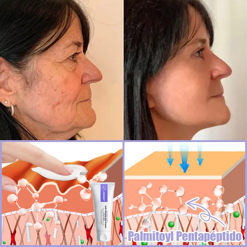 Crema antiarrugas Jorondy® para eliminar arrugas, reafirmar y blanquear la piel - ¡Última oferta!🔥 90 % de descuento.