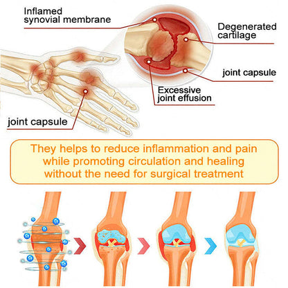 Jorondy® 🐝Bee Venom Pain-Relief Bone Healing Spray （Specially for older adults ）
