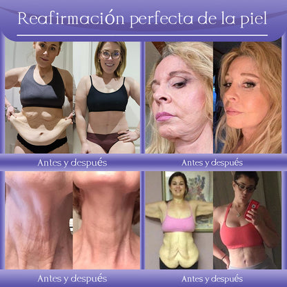 Crema antiarrugas Jorondy® para eliminar arrugas, reafirmar y blanquear la piel - ¡Última oferta!🔥 90 % de descuento.